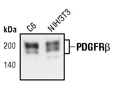 PDGFRB Antibody in Western Blot (WB)