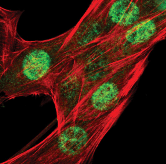 Phospho-CHK1 (Ser345) Antibody in Immunocytochemistry (ICC/IF)