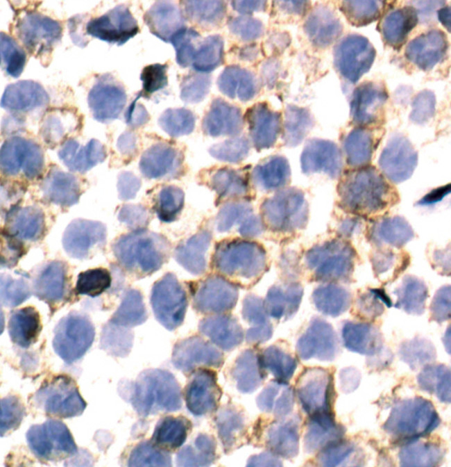 Phospho-CSF1R (Tyr723) Antibody in Immunohistochemistry (Paraffin) (IHC (P))