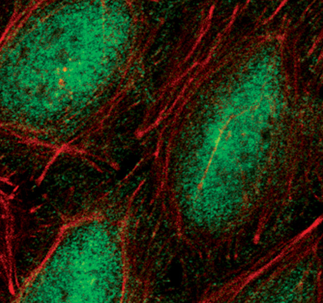 Phospho-NFkB p65 (Ser536) Antibody in Immunocytochemistry (ICC/IF)