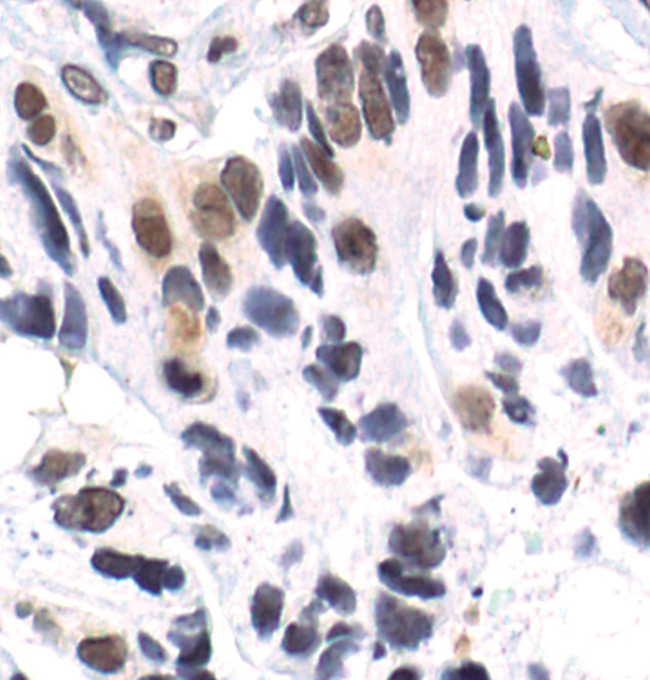 Phospho-p38 MAPK alpha (Thr180, Tyr182) Antibody in Immunohistochemistry (Paraffin) (IHC (P))