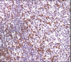 Zap-70 Antibody in Immunohistochemistry (Paraffin) (IHC (P))