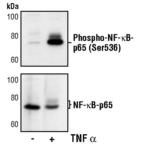 Phospho-NFkB p65 (Ser536) Antibody in Western Blot (WB)