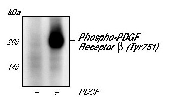 Phospho-PDGFRB (Tyr751) Antibody in Western Blot (WB)