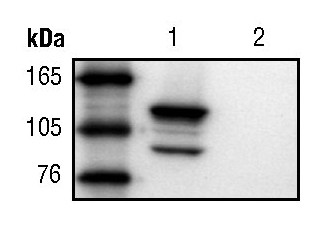 beta Galactosidase Antibody in Western Blot (WB)