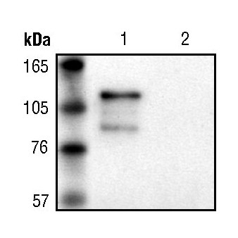 beta Galactosidase Antibody in Immunoprecipitation (IP)