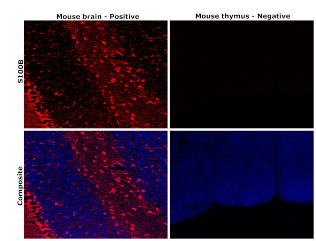 S100B Antibody in Immunohistochemistry (Paraffin) (IHC (P))