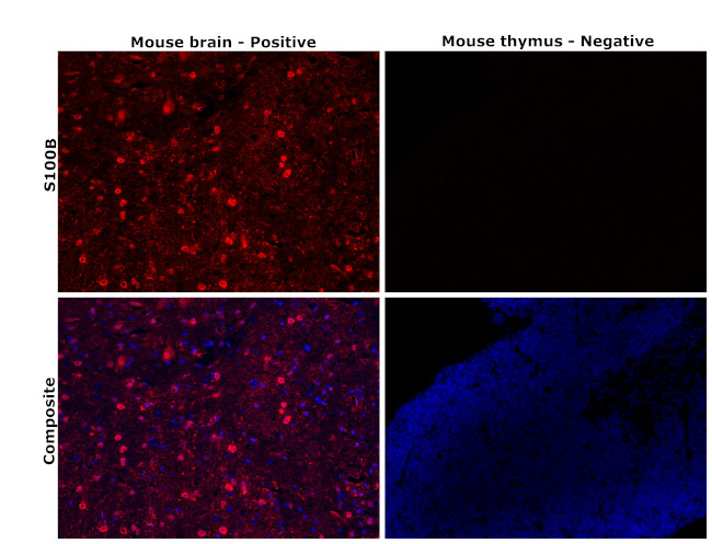 S100B Antibody in Immunohistochemistry (Paraffin) (IHC (P))