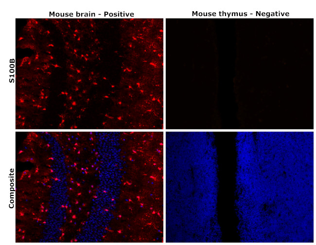 S100B Antibody in Immunohistochemistry (Paraffin) (IHC (P))