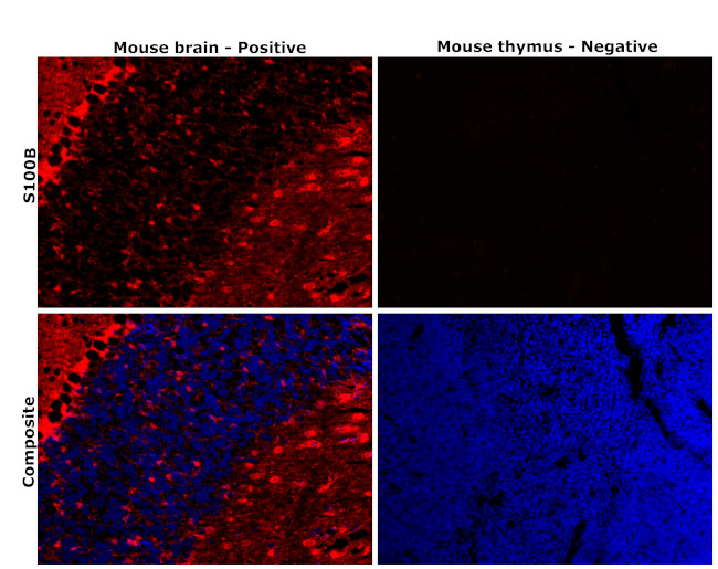 S100B Antibody in Immunohistochemistry (Paraffin) (IHC (P))