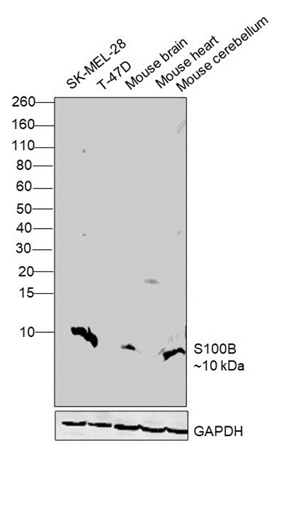 S100B Antibody in Western Blot (WB)