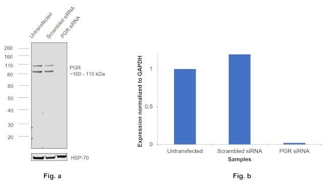 Progesterone Receptor Antibody