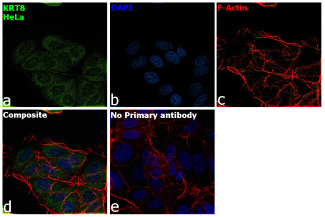 Cytokeratin 8 Antibody in Immunocytochemistry (ICC/IF)