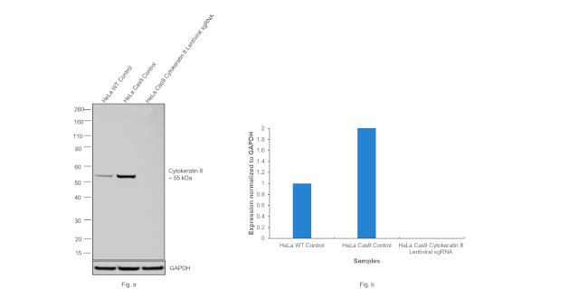 Cytokeratin 8 Antibody