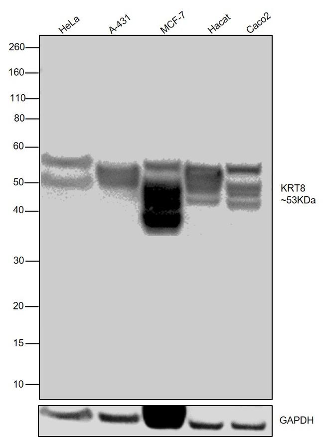 Cytokeratin 8 Antibody in Western Blot (WB)