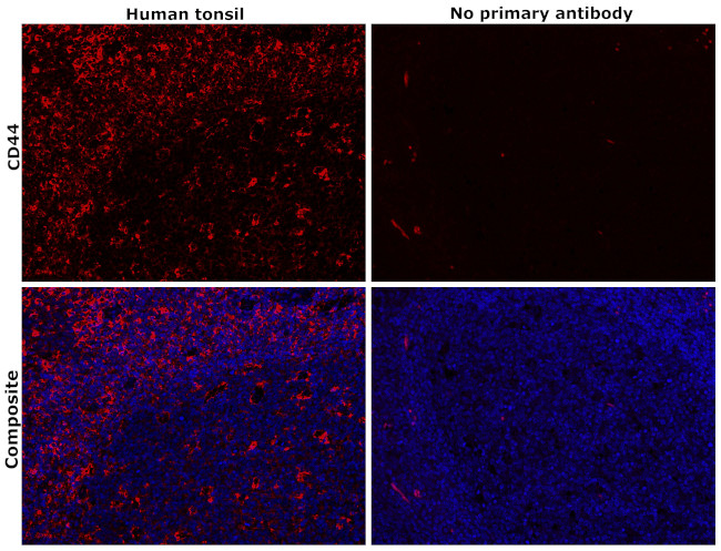 CD44 Antibody in Immunohistochemistry (Paraffin) (IHC (P))