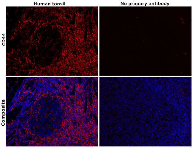 CD44 Antibody in Immunohistochemistry (Paraffin) (IHC (P))