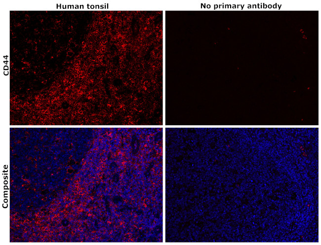 CD44 Antibody in Immunohistochemistry (Paraffin) (IHC (P))