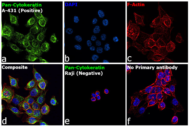 Cytokeratin Pan Antibody in Immunocytochemistry (ICC/IF)