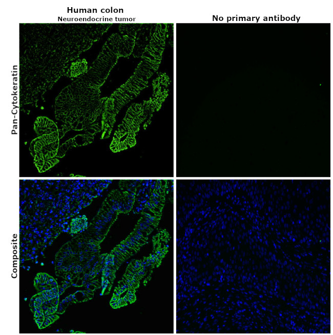 Cytokeratin Pan Antibody in Immunohistochemistry (Paraffin) (IHC (P))