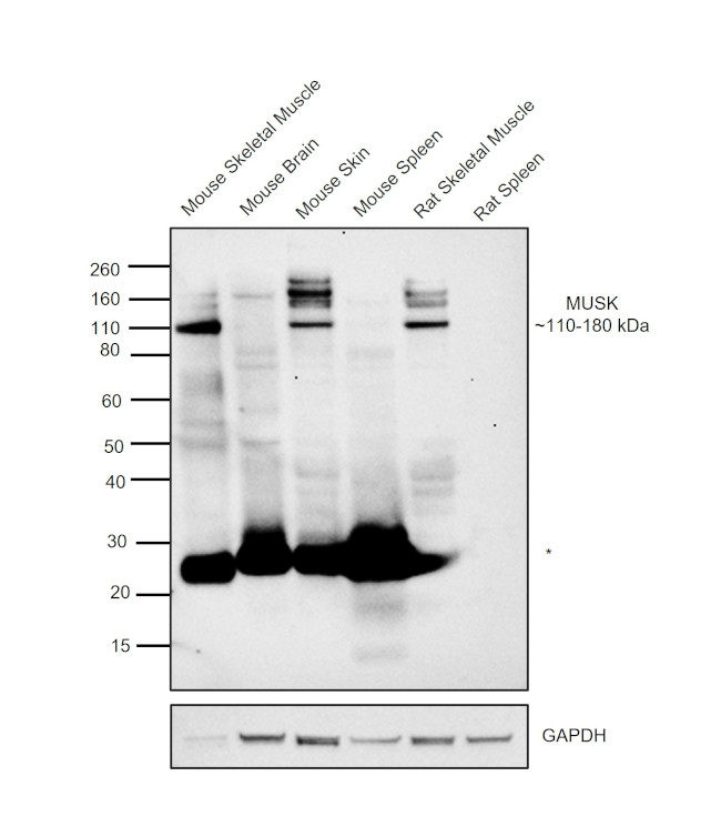 MUSK Antibody