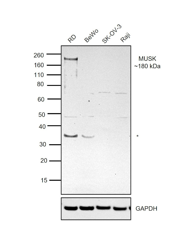 MUSK Antibody in Western Blot (WB)