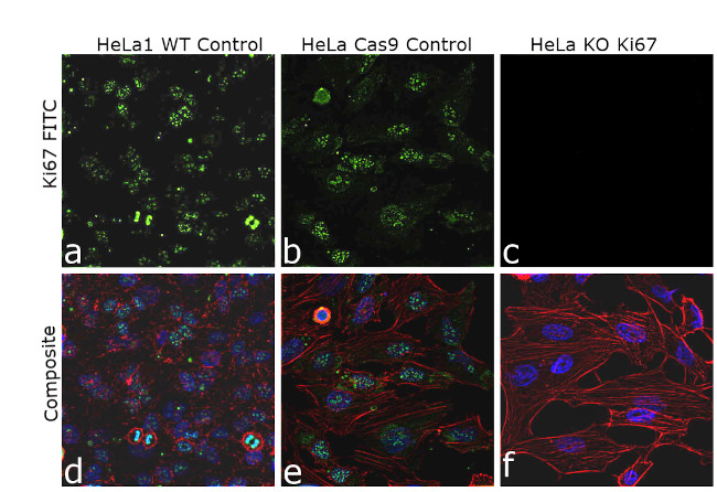 Ki-67 Antibody