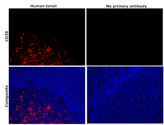 CD38 Antibody in Immunohistochemistry (Paraffin) (IHC (P))