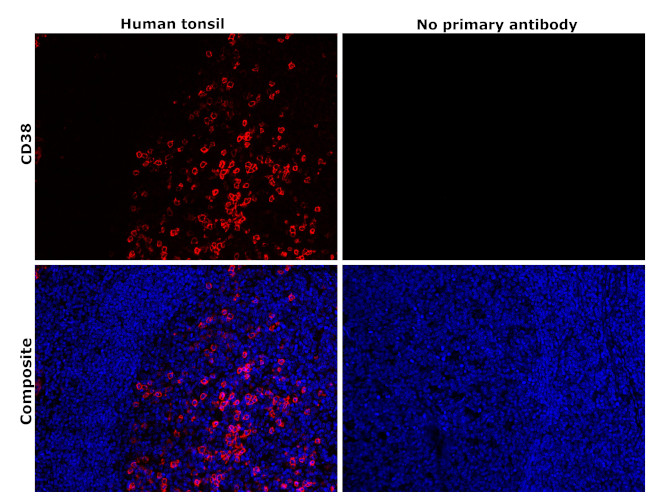 CD38 Antibody in Immunohistochemistry (Paraffin) (IHC (P))