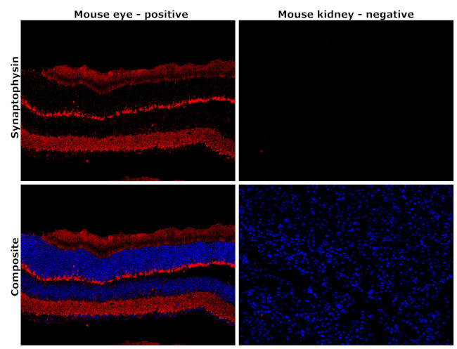 Synaptophysin Antibody in Immunohistochemistry (Paraffin) (IHC (P))