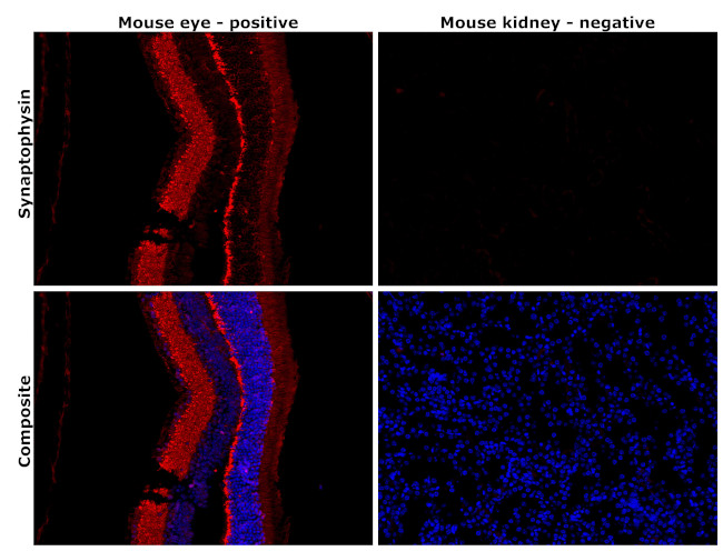 Synaptophysin Antibody in Immunohistochemistry (Paraffin) (IHC (P))