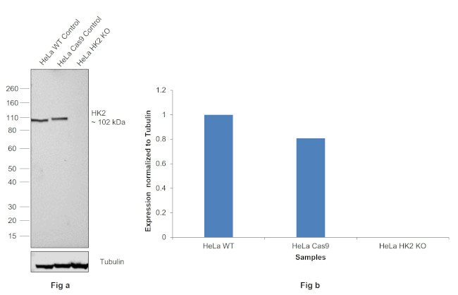 HK2 Antibody in Western Blot (WB)