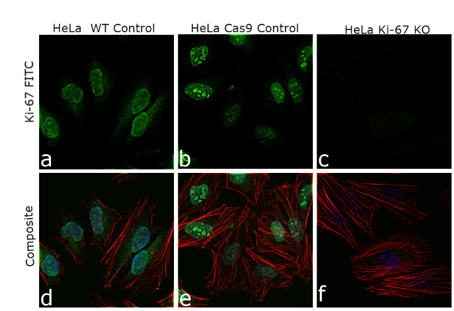 Ki-67 Antibody