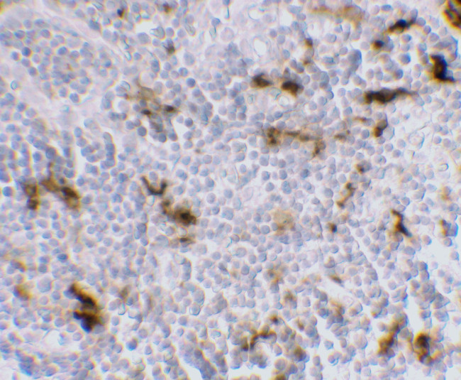 DC-SIGN Antibody in Immunohistochemistry (IHC)