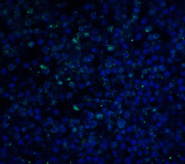 PD-1 Antibody in Immunohistochemistry (IHC)