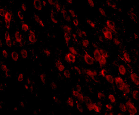 PD-1 Antibody in Immunohistochemistry (IHC)