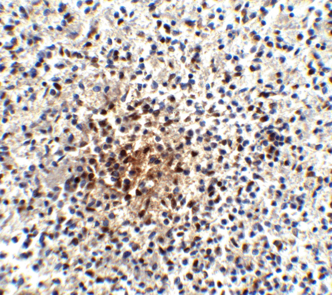 PD-1 Antibody in Immunohistochemistry (IHC)