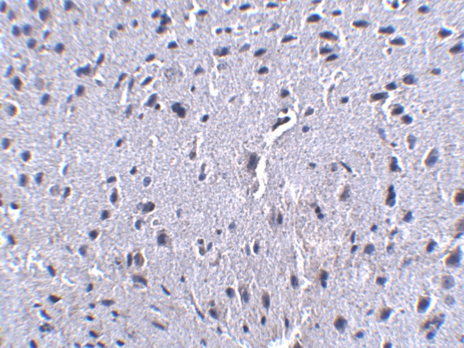 PD-1 Antibody in Immunohistochemistry (IHC)