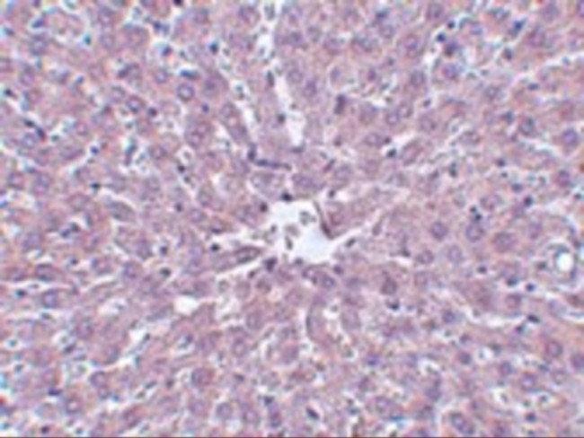 IRAK1 Antibody in Immunohistochemistry (IHC)