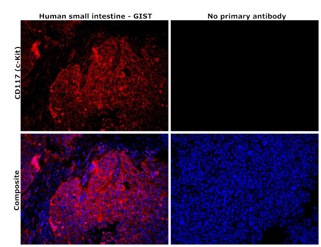 c-Kit Antibody in Immunohistochemistry (Paraffin) (IHC (P))