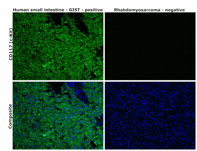 c-Kit Antibody in Immunohistochemistry (Paraffin) (IHC (P))