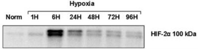 HIF-2 alpha Antibody in Western Blot (WB)