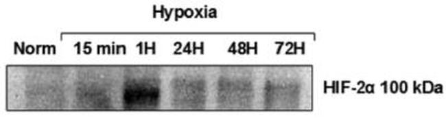 HIF-2 alpha Antibody in Western Blot (WB)