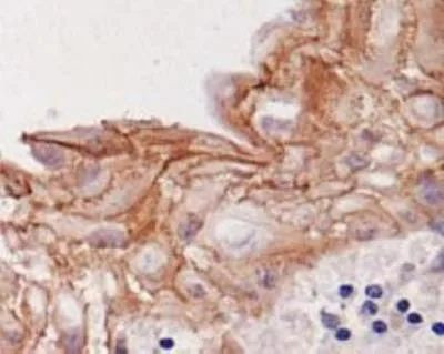 Desmoglein 3 Antibody in Immunohistochemistry (Paraffin) (IHC (P))