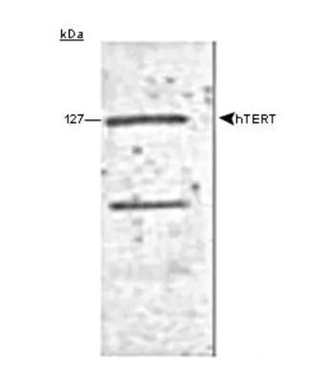 TERT Antibody in Western Blot (WB)