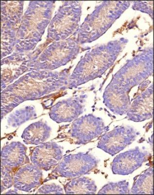 MRP1 Antibody in Immunohistochemistry (Paraffin) (IHC (P))