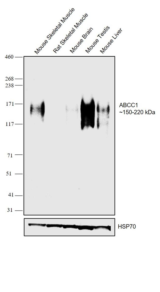 MRP1 Antibody in Western Blot (WB)