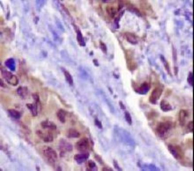 NAPSA Antibody in Immunohistochemistry (Paraffin) (IHC (P))