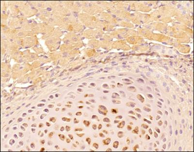 Tenascin C Antibody in Immunohistochemistry (Paraffin) (IHC (P))