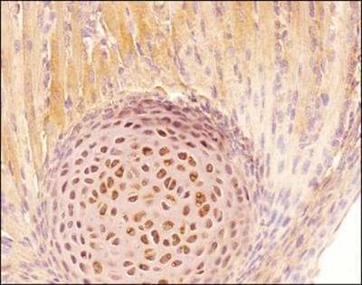 Tenascin C Antibody in Immunohistochemistry (Paraffin) (IHC (P))